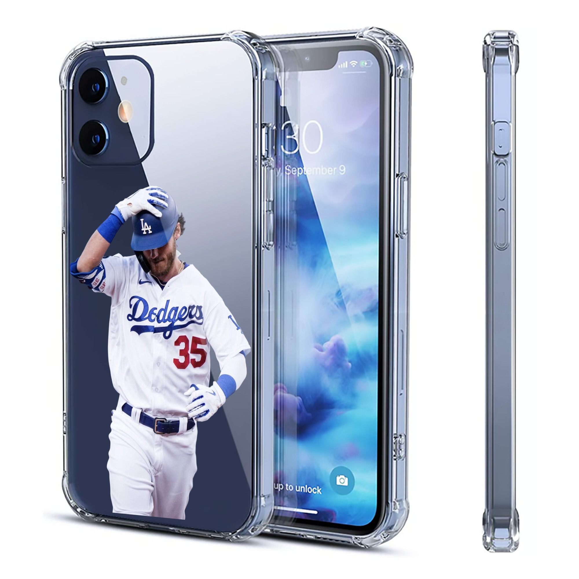  Clear IPhone 12 Case – Soft TPU With UV Print – Enhanced Drop Protection, Precise Fit, Anti-Fingerprint, Customizable Design, Scratch-Resistant, Yellow-Resistant